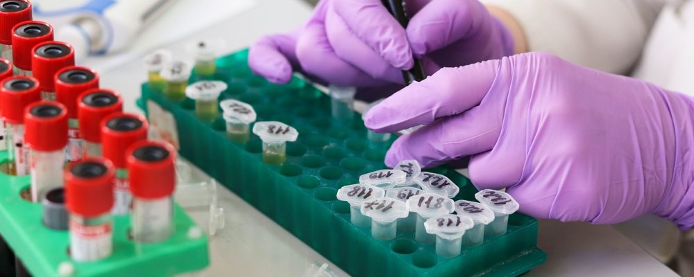 Part-Time FD - Medtech startup - London 1 laboratory 3827745 1280